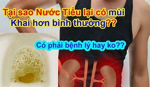 Nước Tiểu Không Có Mùi Khai Là Bệnh Gì