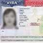 Xkld Đức 2022 Là Gì Khi Nào Hết Hạn Visa Mỹ